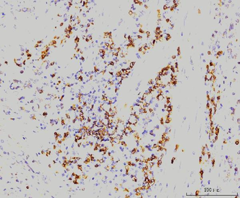 Rab11A Mouse Monoclonal Antibody