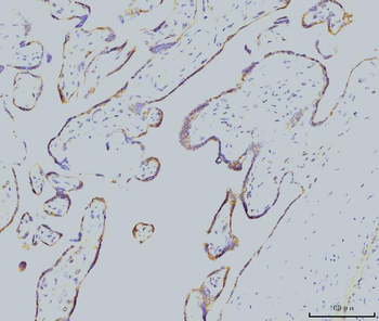 Rab11A Mouse Monoclonal Antibody