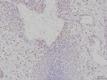 Rab11A Mouse Monoclonal Antibody