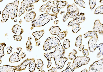Cyclophilin E/PPIE Mouse Monoclonal Antibody