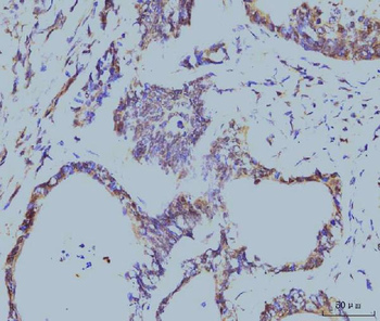 Cyclophilin E/PPIE Mouse Monoclonal Antibody
