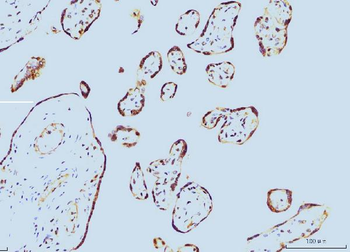 Cyclophilin E/PPIE Mouse Monoclonal Antibody
