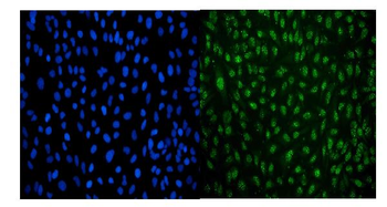 LSM8 Mouse Monoclonal Antibody