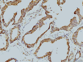LSM8 Mouse Monoclonal Antibody