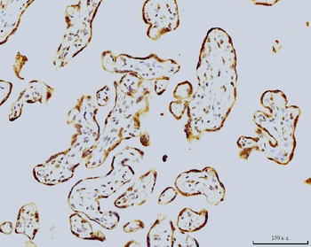 LSM8 Mouse Monoclonal Antibody