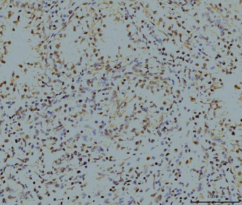 LSM8 Mouse Monoclonal Antibody