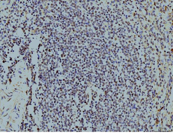 LSM8 Mouse Monoclonal Antibody