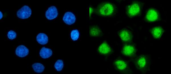 TBP-1/PSMC3/TBP Mouse Monoclonal Antibody
