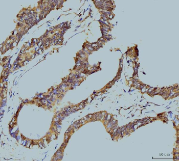 TBP-1/PSMC3/TBP Mouse Monoclonal Antibody