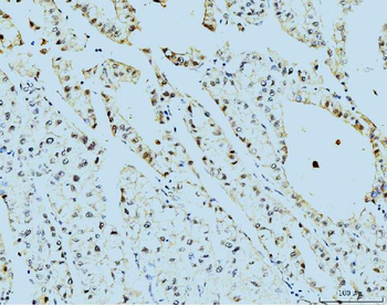 TBP-1/PSMC3/TBP Mouse Monoclonal Antibody