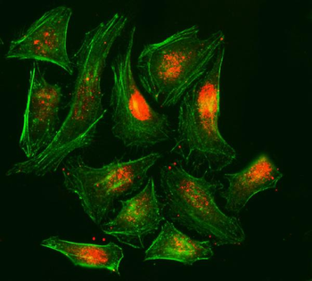 RPA32/RPA2 Mouse Monoclonal Antibody