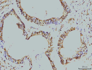 RPA32/RPA2 Mouse Monoclonal Antibody