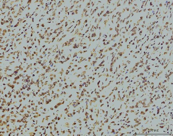 RPA32/RPA2 Mouse Monoclonal Antibody