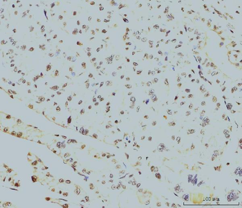 RPA32/RPA2 Mouse Monoclonal Antibody