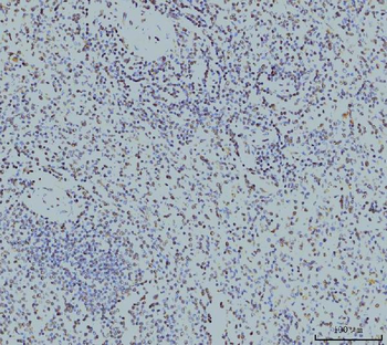 RPA32/RPA2 Mouse Monoclonal Antibody