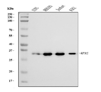 RPA32/RPA2 Mouse Monoclonal Antibody