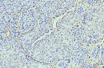 Annexin VI Mouse Monoclonal Antibody