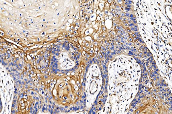 POR Mouse Monoclonal Antibody