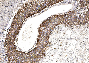 POR Mouse Monoclonal Antibody