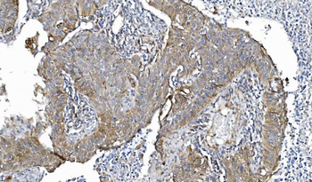 POR Mouse Monoclonal Antibody