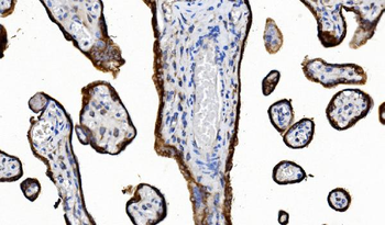 POR Mouse Monoclonal Antibody