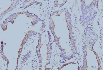 EIF4A1 Mouse Monoclonal Antibody