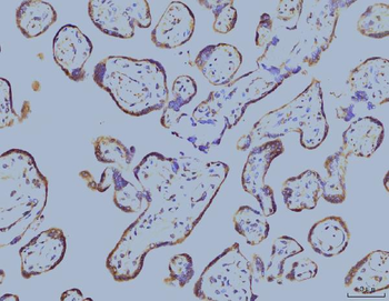 EIF4A1 Mouse Monoclonal Antibody