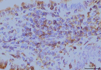 EIF4A1 Mouse Monoclonal Antibody