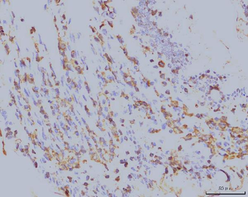 EIF4A1 Mouse Monoclonal Antibody
