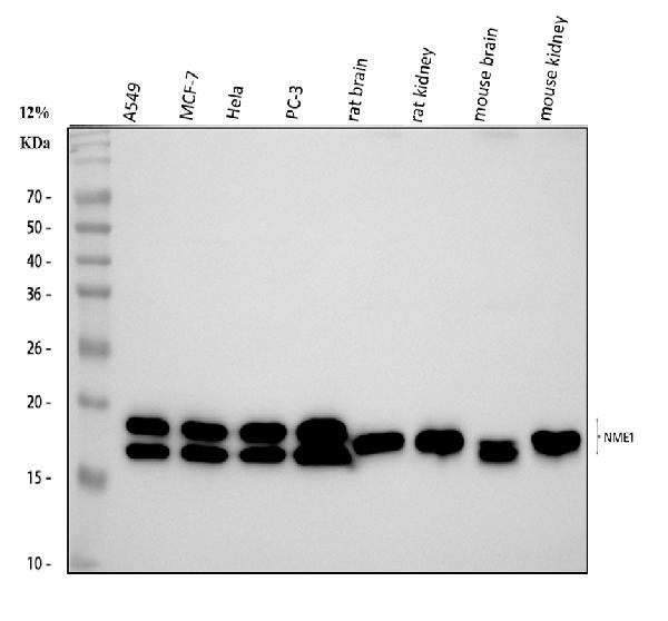NM23A/NME1 Rabbit Polyclonal Antibody