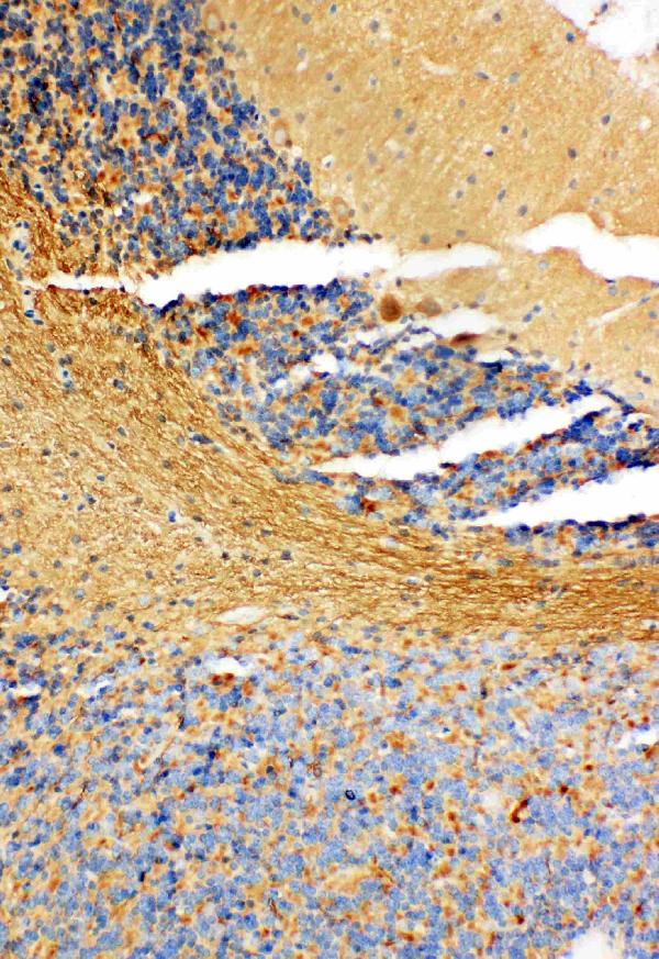 NM23A/NME1 Rabbit Polyclonal Antibody