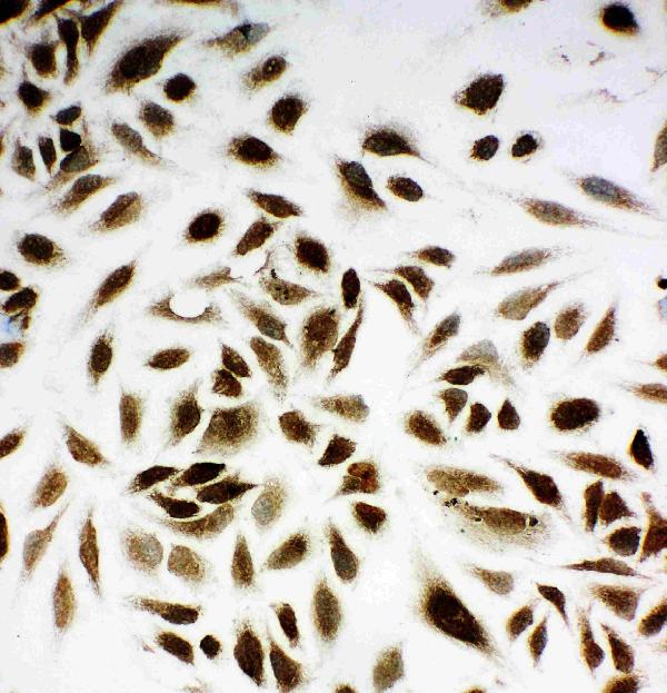 NM23A/NME1 Rabbit Polyclonal Antibody