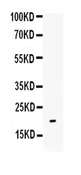 Interleukin-10 IL10/10 Rabbit Polyclonal Antibody