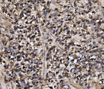 ADRM1/ARM-1/ARM Rabbit Polyclonal Antibody