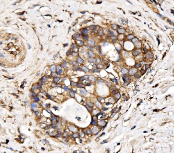 IRBIT/AHCYL1 Rabbit Polyclonal Antibody