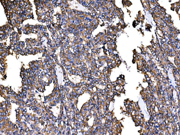 IRBIT/AHCYL1 Rabbit Polyclonal Antibody