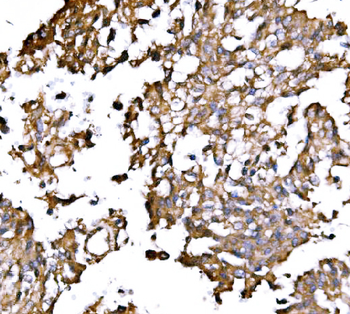 IRBIT/AHCYL1 Rabbit Polyclonal Antibody