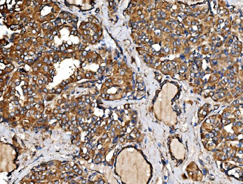 IRBIT/AHCYL1 Rabbit Polyclonal Antibody