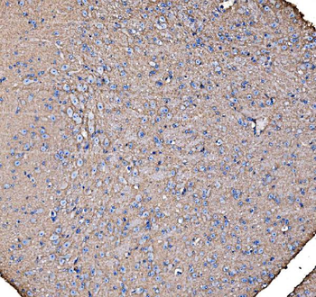 IRBIT/AHCYL1 Rabbit Polyclonal Antibody