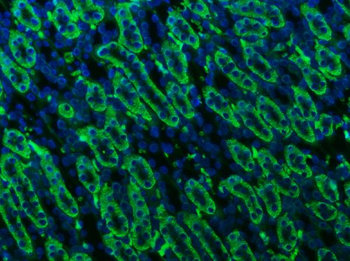 ATP1B1 Rabbit Polyclonal Antibody