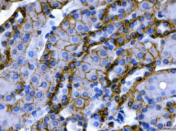 ATP1B1 Rabbit Polyclonal Antibody