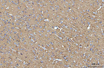 ATP1B1 Rabbit Polyclonal Antibody