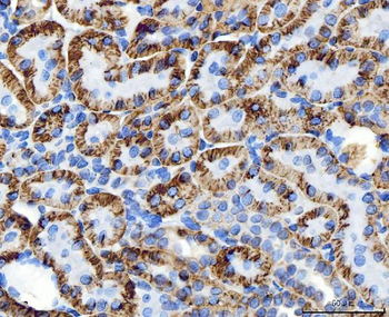 ATP1B1 Rabbit Polyclonal Antibody
