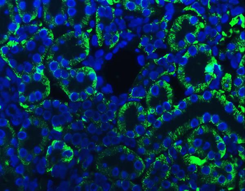 ATP1B1 Rabbit Polyclonal Antibody