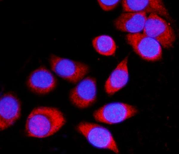 ATP1B1 Rabbit Polyclonal Antibody