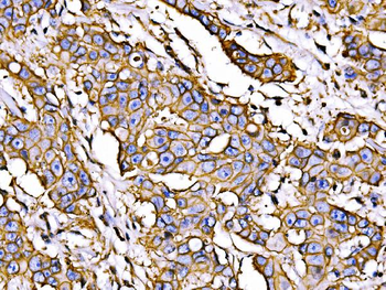 ATP1B1 Rabbit Polyclonal Antibody