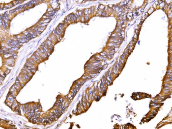 ATP1B1 Rabbit Polyclonal Antibody