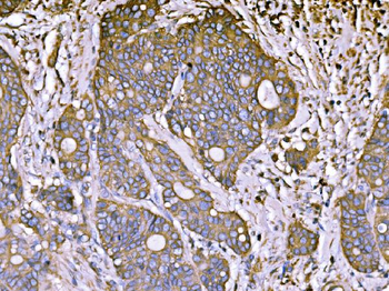 ATP1B1 Rabbit Polyclonal Antibody