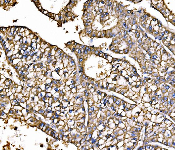 ATP1B1 Rabbit Polyclonal Antibody