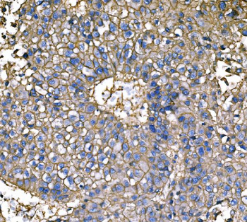 ATP1B1 Rabbit Polyclonal Antibody